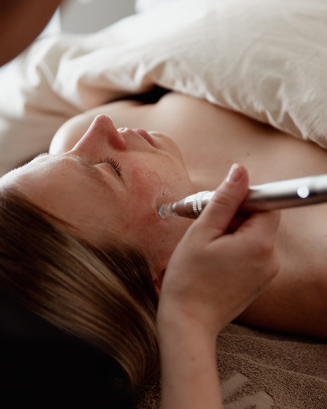 Needling behandling