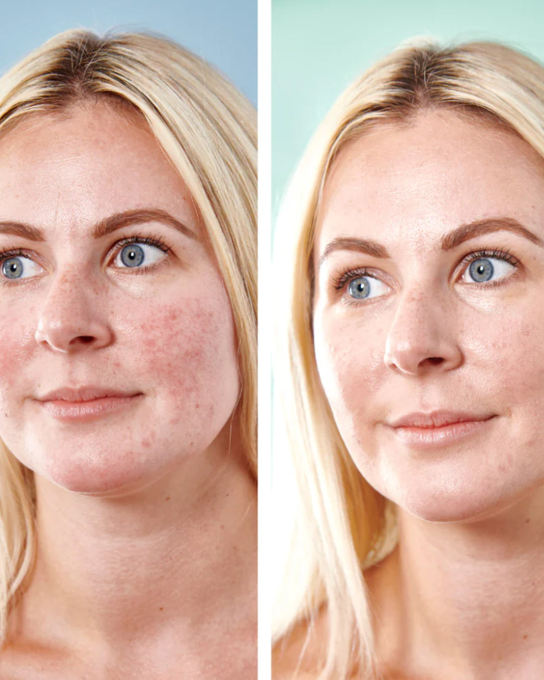 5 in 1 Anti-Redness Day Cream SPF50