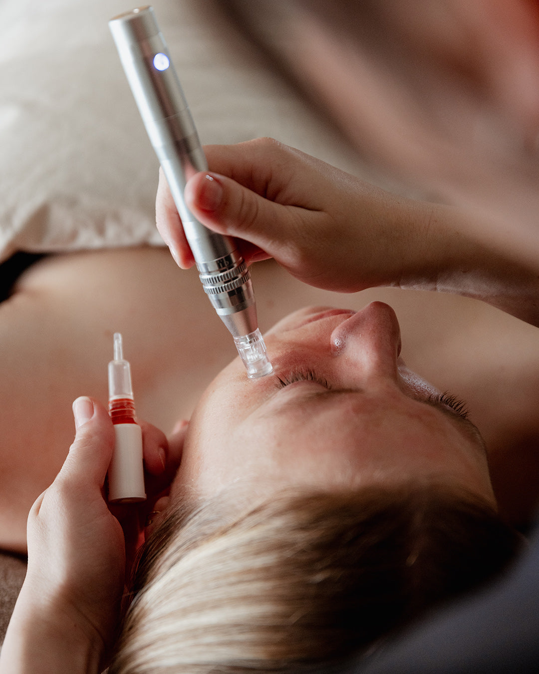 Needling behandling