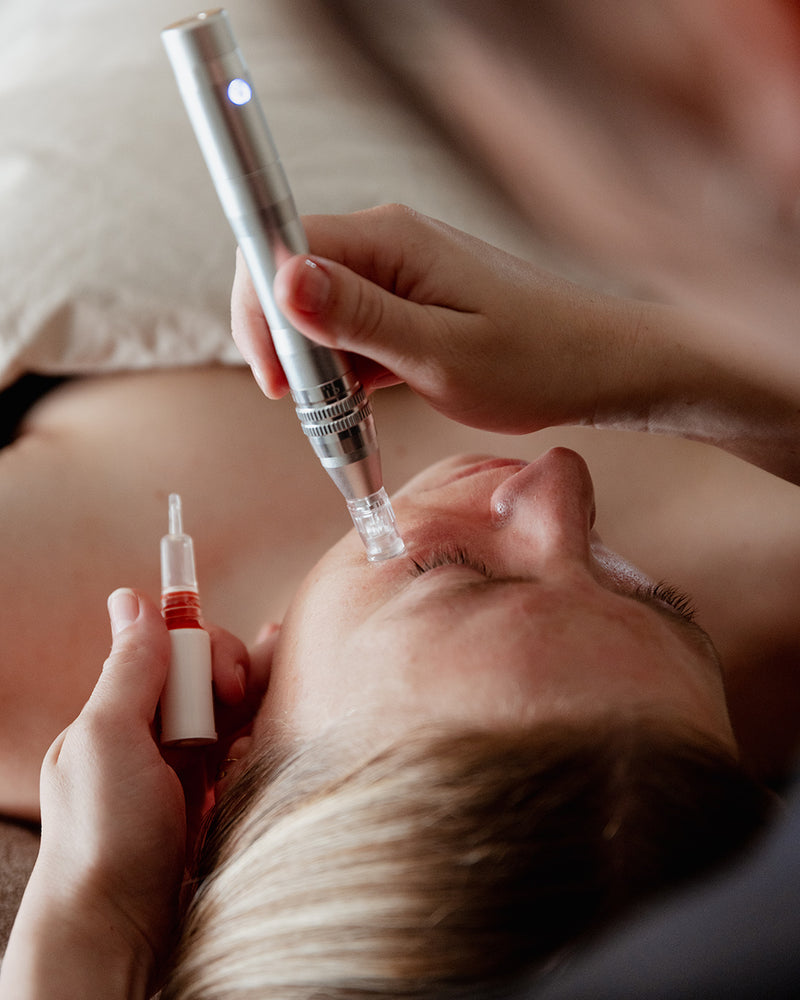 Nano Needling Ansigtsbehandling